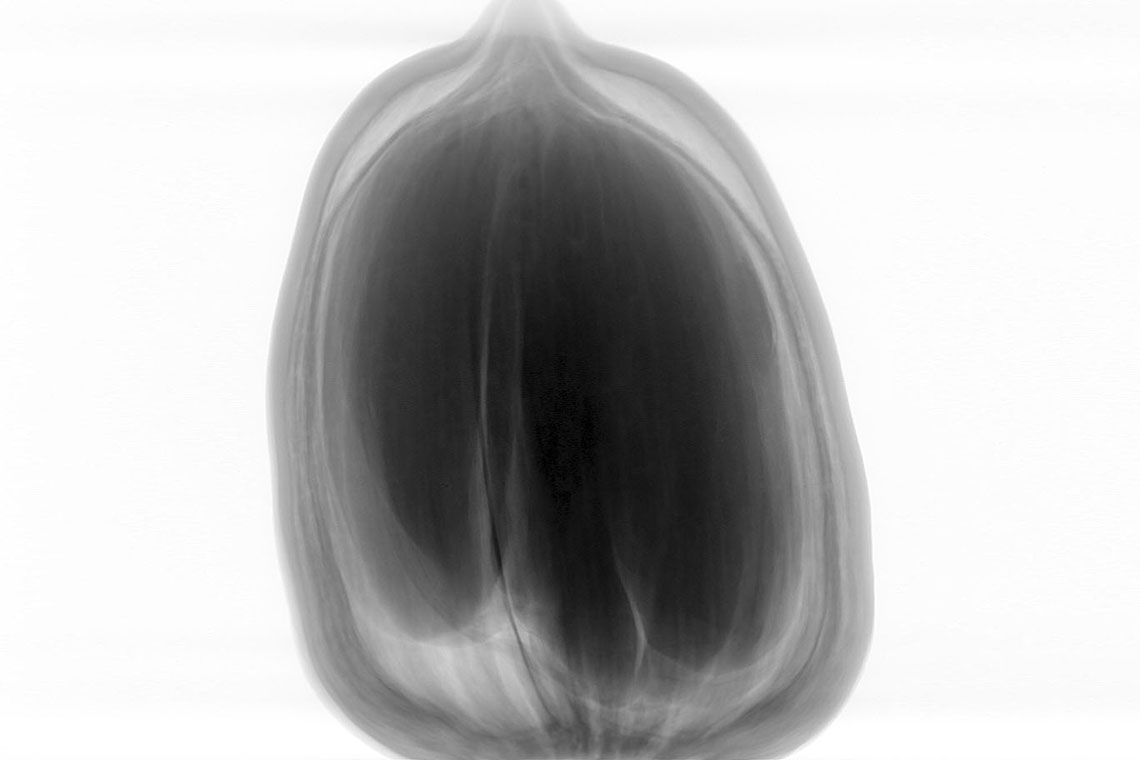 Digital Radiography image of acorn