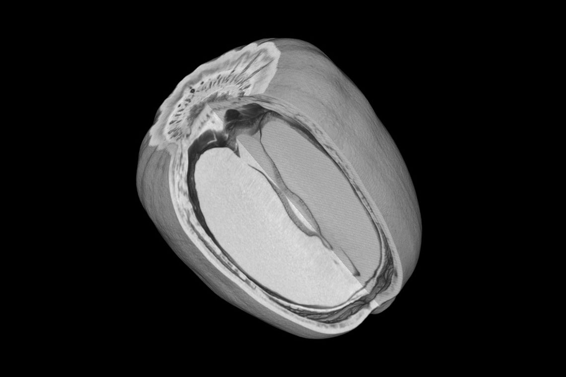 Micro-CT image of acorn